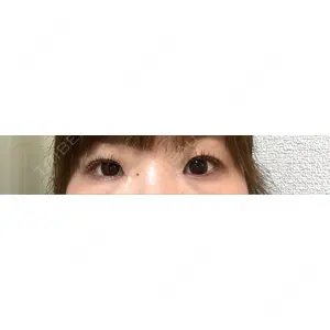 口コミ