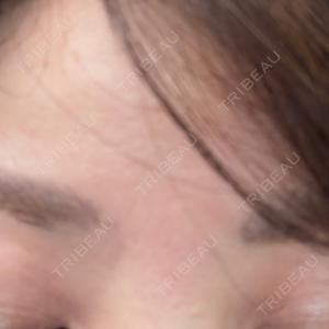 TCB東京中央美容外科 TCB東京中央美容外科 三島院口コミ