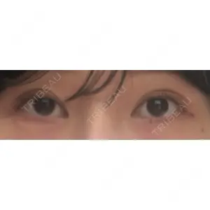 フィラークリニック フィラークリニック 新宿院口コミ