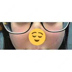 やさしい美容皮膚科・皮フ科 やさしい美容皮膚科・皮フ科　東京浅草院口コミ