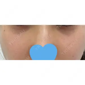 やさしい美容皮膚科・皮フ科 やさしい美容皮膚科・皮フ科　東京浅草院口コミ