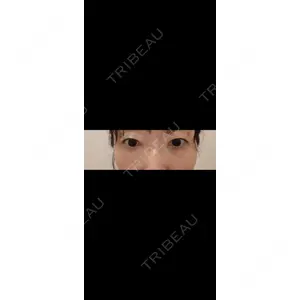 TCB東京中央美容外科 TCB東京中央美容外科 岡山院口コミ