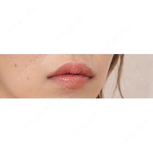 アリエル美容クリニック アリエル美容クリニック 横浜院口コミ