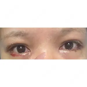 BIANCA CLINIC BIANCA銀座口コミ