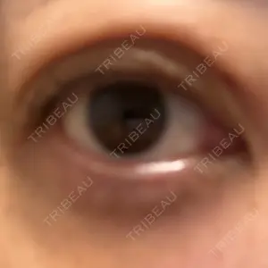 HAAB CLINIC HAAB×DREAM BEAUTY CLINIC 大阪梅田院口コミ