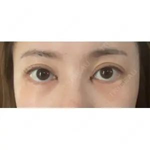 プロクリニック PRO CLINIC プロクリニック 銀座院口コミ