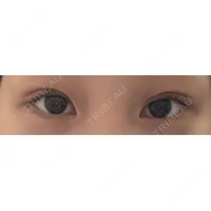 HAAB×DREAM BEAUTY CLINIC 大阪梅田院の