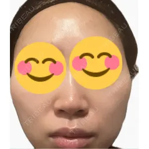 口コミ