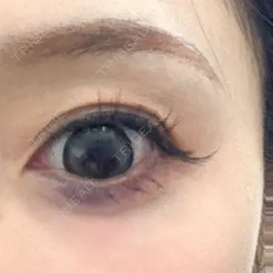 新未来クリニック口コミ