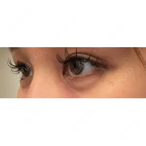 プロクリニック PRO CLINIC プロクリニック 銀座院口コミ