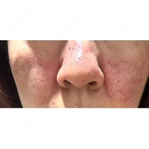 APスキンクリニック銀座口コミ