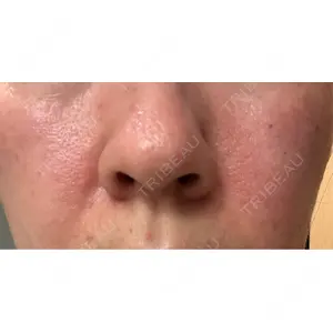 APスキンクリニック銀座口コミ