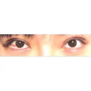 東京シンデレラ美容外科 東京シンデレラ美容外科 池袋院口コミ