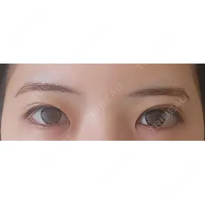 LUHO（ルホ）美容外科口コミ