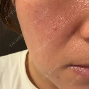 おおかみ美容のクリニック おおかみ美容のクリニック 新宿院口コミ