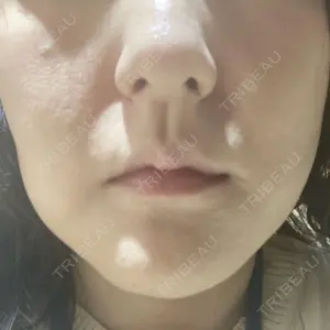 HAAB CLINIC HAAB×DREAM BEAUTY CLINIC 大阪梅田院口コミ