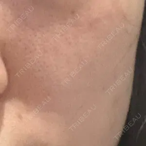 MIO CLINIC 梅田院口コミ