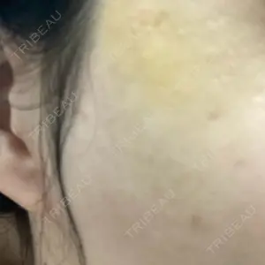 HAAB CLINIC HAAB×DREAM BEAUTY CLINIC 大阪梅田院口コミ