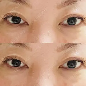 HAAB CLINIC HAAB×DREAM BEAUTY CLINIC 大阪梅田院口コミ