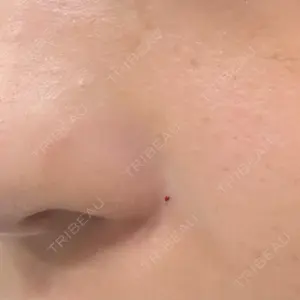 HAAB CLINIC HAAB BEAUTY CLINIC 名古屋院口コミ