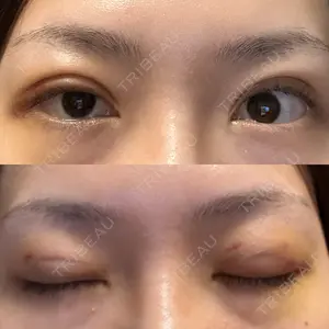 アリエル美容クリニック アリエル美容クリニック 大宮院口コミ