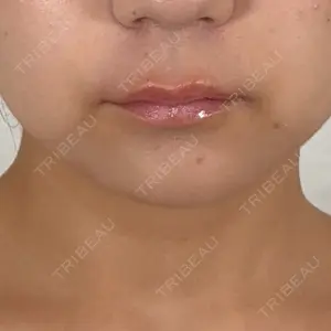 アリエル美容クリニック アリエル美容クリニック 横浜院口コミ