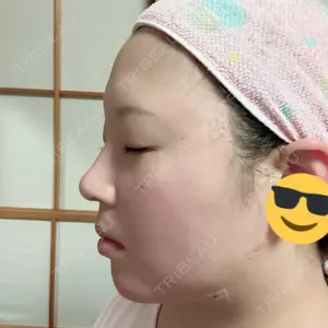 ハナビューティークリニック口コミ