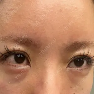 東京形成美容外科 東京形成美容外科 船橋院口コミ