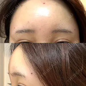 LA CLEF CLINIC（ラクレクリニック）口コミ