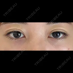 フィラークリニック フィラークリニック 新宿院口コミ