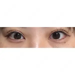 口コミ