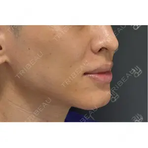 EMMO FACE CLINIC EMMO FACE CLINIC 東京三田院口コミ