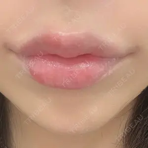 口コミ
