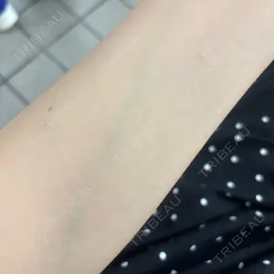 美容皮膚科アイエスクリニック 美容皮膚科アイエスクリニック六本木院口コミ