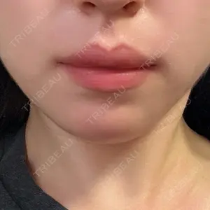 アリエル美容クリニック アリエル美容クリニック 横浜院口コミ
