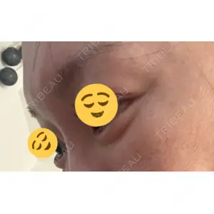 プロクリニック PRO CLINIC プロクリニック 銀座院口コミ