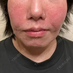 ルラ美容クリニック ルラ美容クリニック 新宿院口コミ