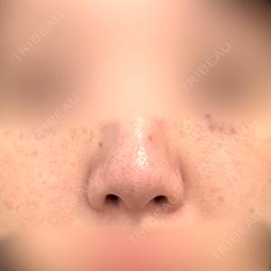 Fellez Clinic【フェルズクリニック】口コミ