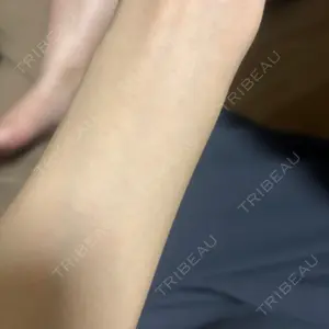 美容皮膚科アイエスクリニック 美容皮膚科アイエスクリニック六本木院口コミ