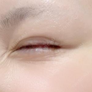 プロクリニック PRO CLINIC プロクリニック 銀座院口コミ