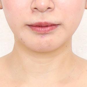 アリエル美容クリニック アリエル美容クリニック 横浜院口コミ
