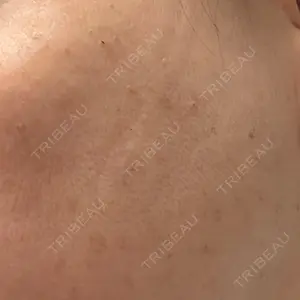 ルラ美容クリニック ルラライト美容クリニック 八王子院口コミ