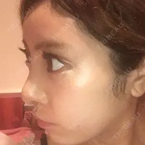 HANABI整形外科口コミ