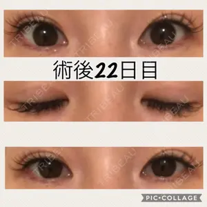 口コミ