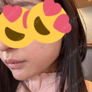 DMTC CLINIC DMTC美容皮膚科 大宮院口コミ