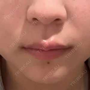 HAAB CLINIC HAAB×DREAM BEAUTY CLINIC 大阪梅田院口コミ