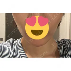 ハナビューティークリニック口コミ