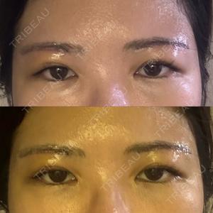 もとび美容外科クリニック 新宿院口コミ