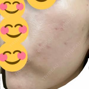 NEO Skin Clinic NEO Skin Clinic恵比寿口コミ