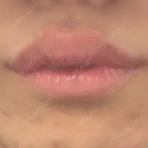フィラークリニック フィラークリニック 新宿院口コミ